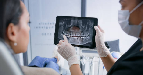 Licensed Teeth Whitening service in Powder Springs, GA - Smile Center Dentistry